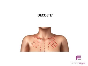 Fili riassorbenti per decoltè