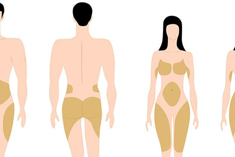 adiposità localizzate nell'uomo e nella donna