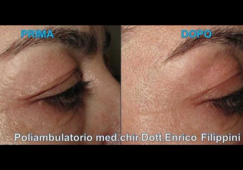 Chirurgia non ablativa