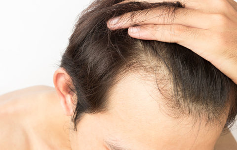 ricrescita capelli