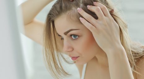 cura alopecia femminile