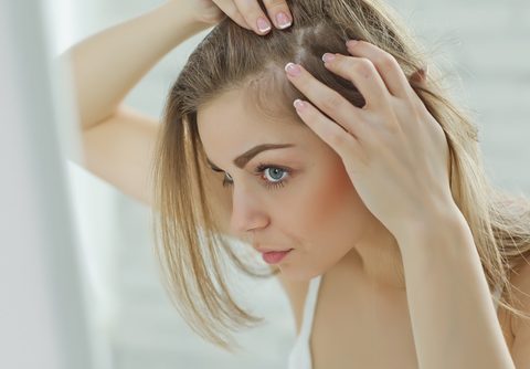 cura alopecia femminile