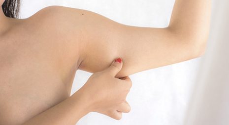 cellulite braccia menopausa