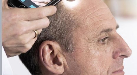 malattie_capelli_brescia