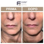 reshape-basso-viso